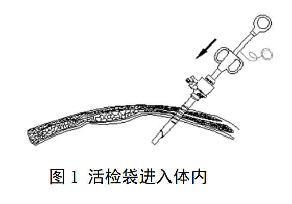一次性使用内窥镜用活检袋注册审查指导原则（2025年最新版）