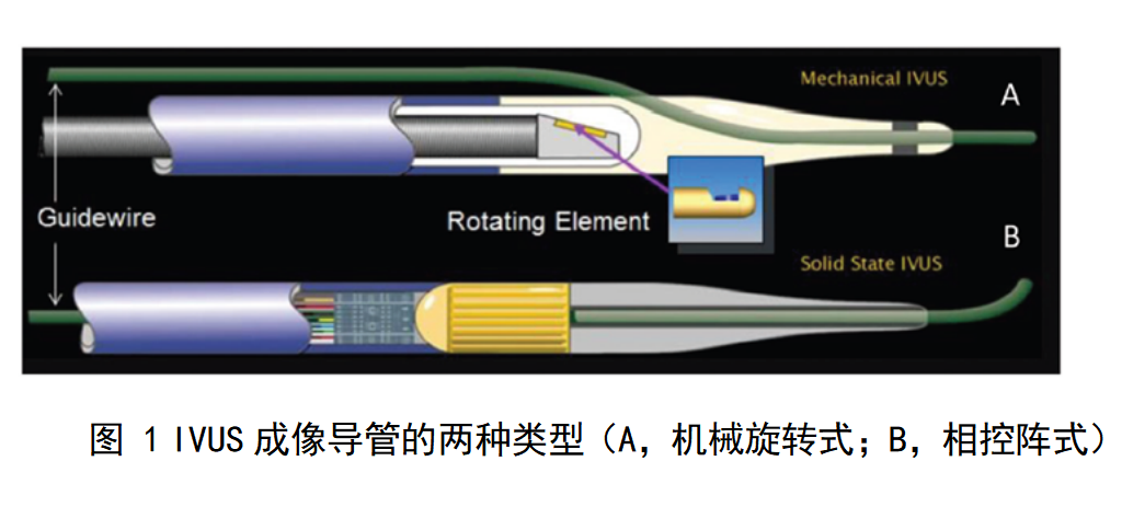 血管内超声诊断设备注册审查指导原则（征求意见稿）-2025年最新版
