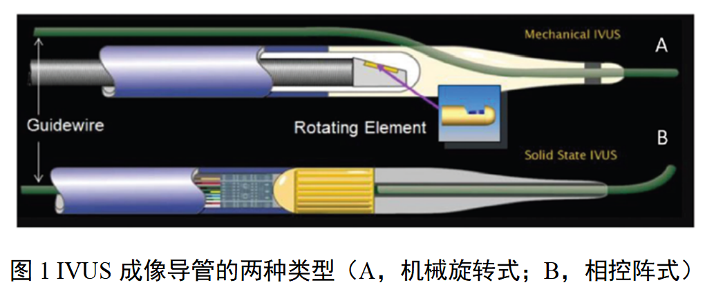 血管内超声诊断设备注册审查指导原则（2026年版）